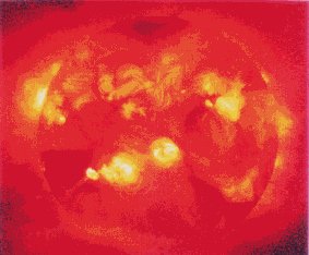 衛星ようこうによる太陽の軟Ｘ線写真